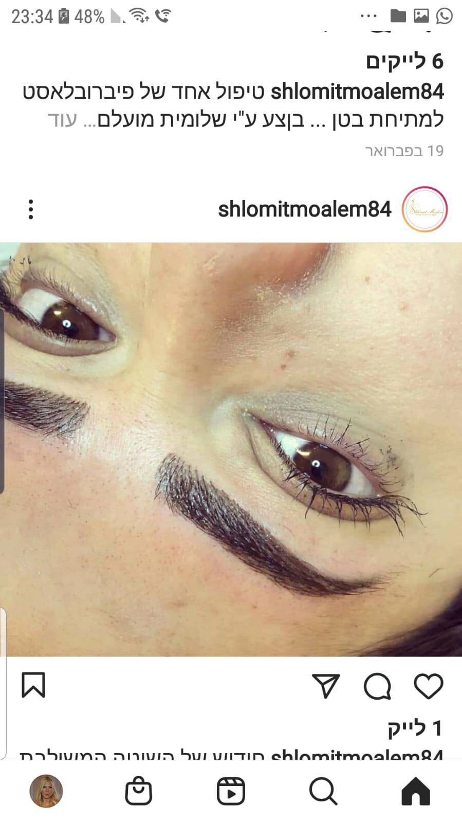 מרטין מרכז לטיפולים אסתטיים ור