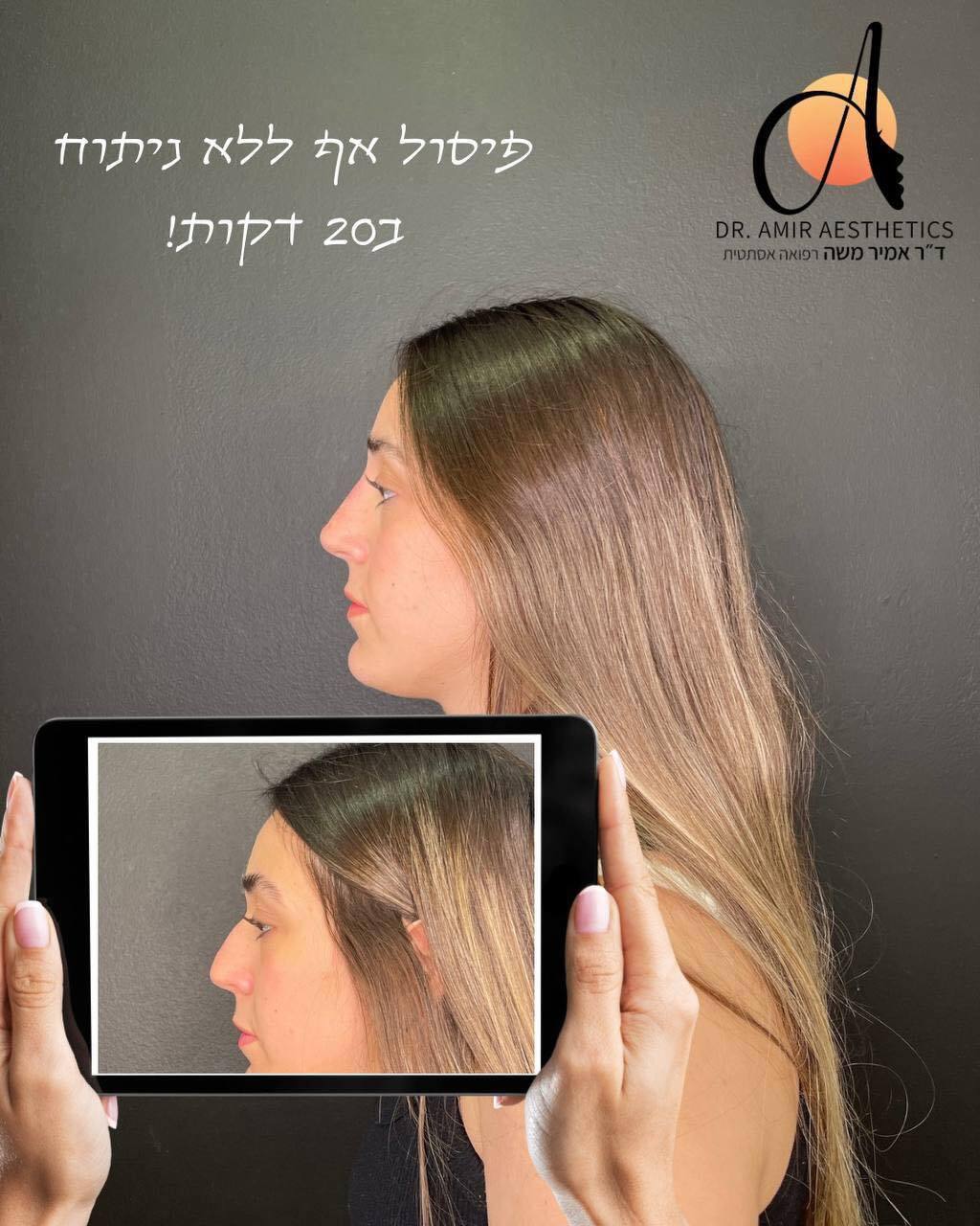 אמיר אסתטיק בע''מ