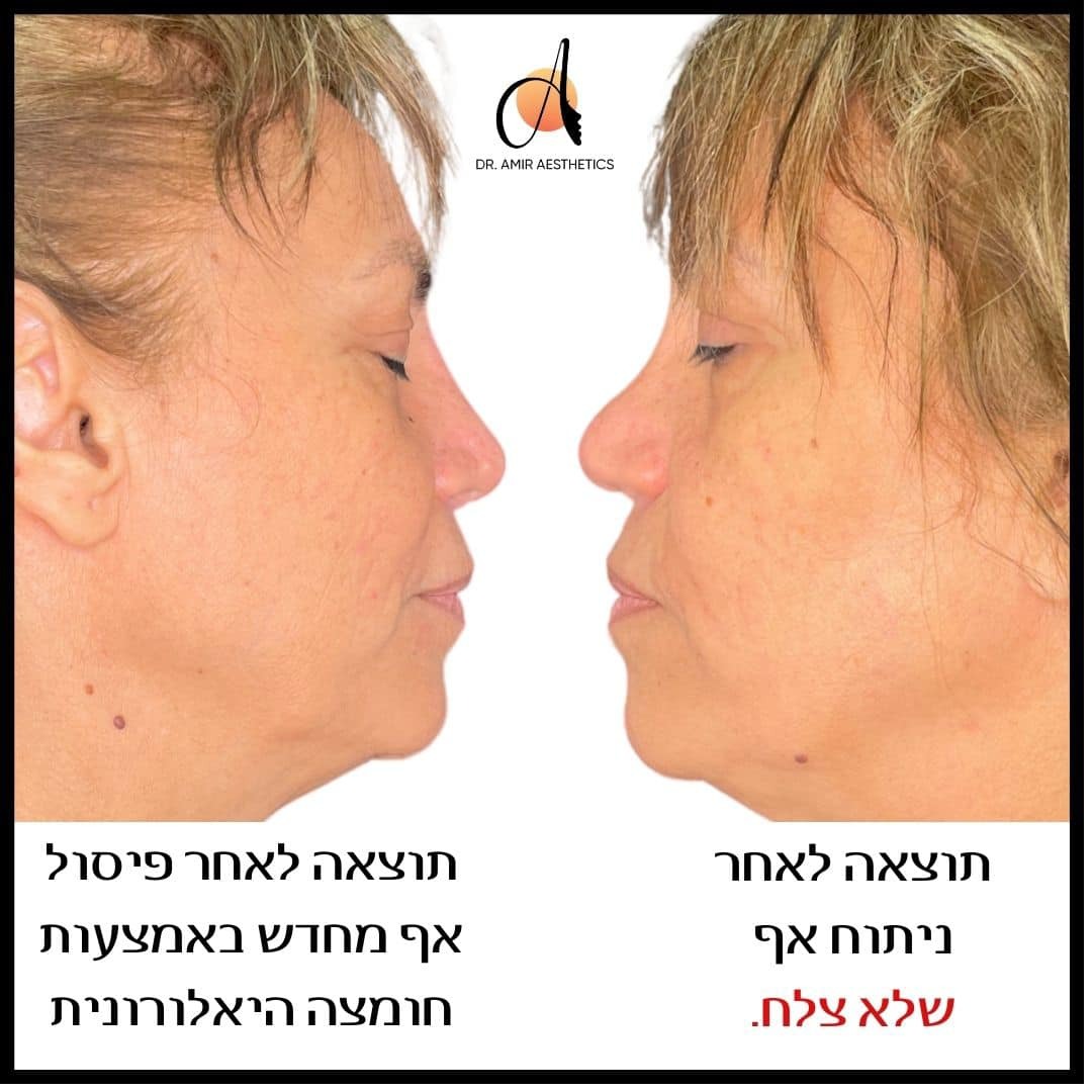 אמיר אסתטיק בע''מ
