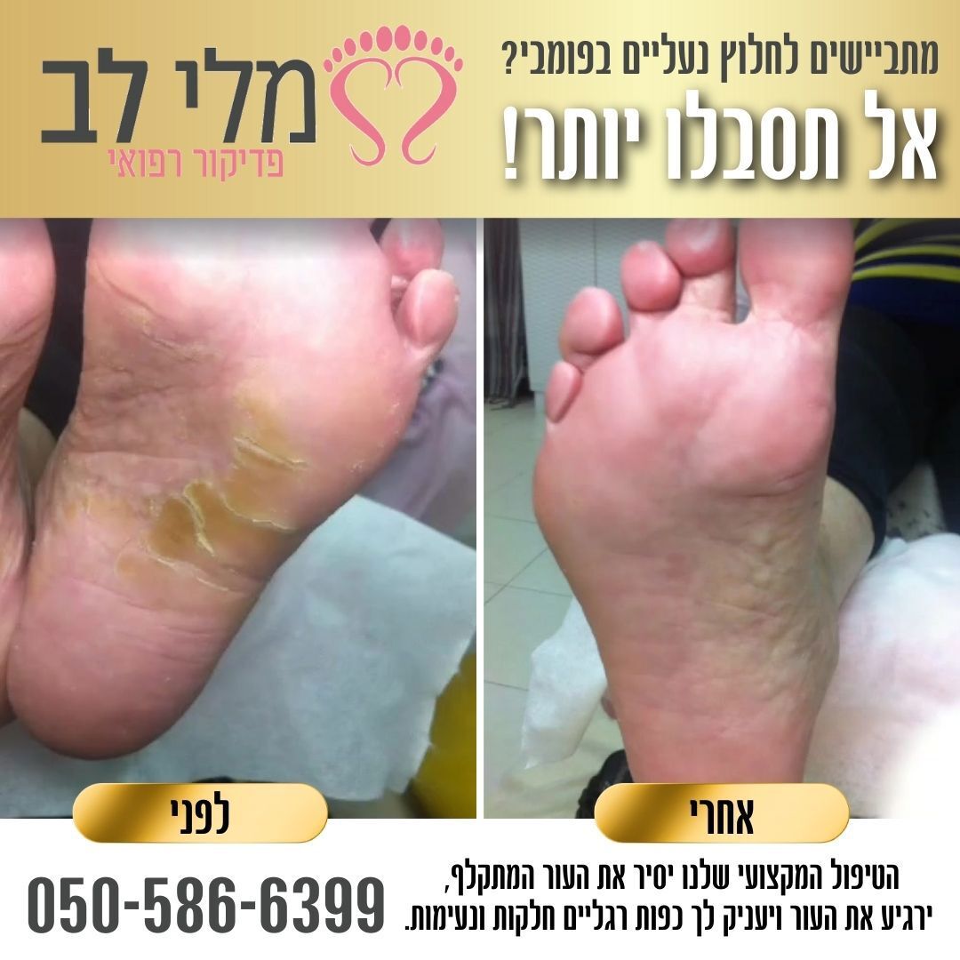 מלי לב - פדיקור רפואי 