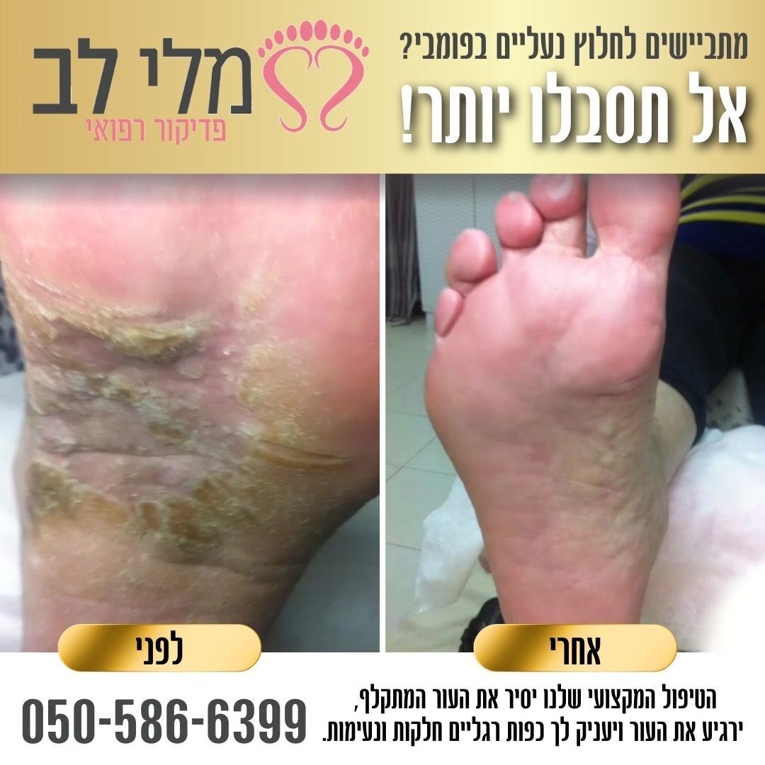 מלי לב - פדיקור רפואי 