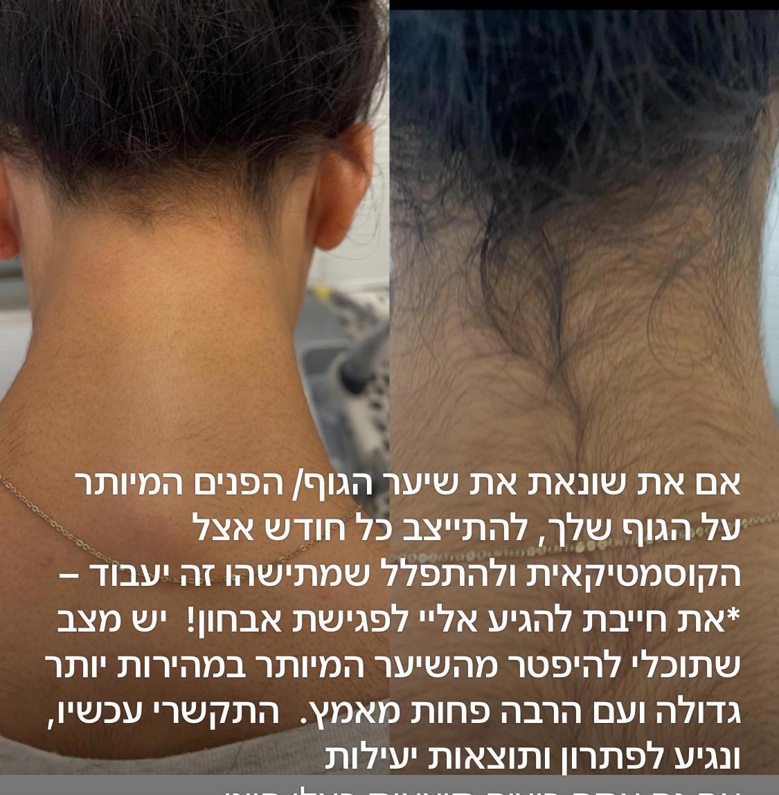 אמירה קליניקה לקוסמטיקה מתקדמת