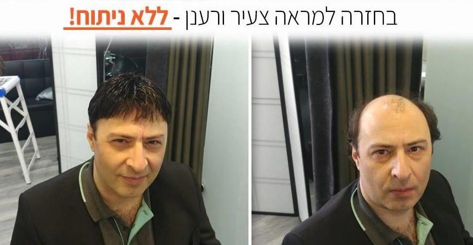 השלמות שיער